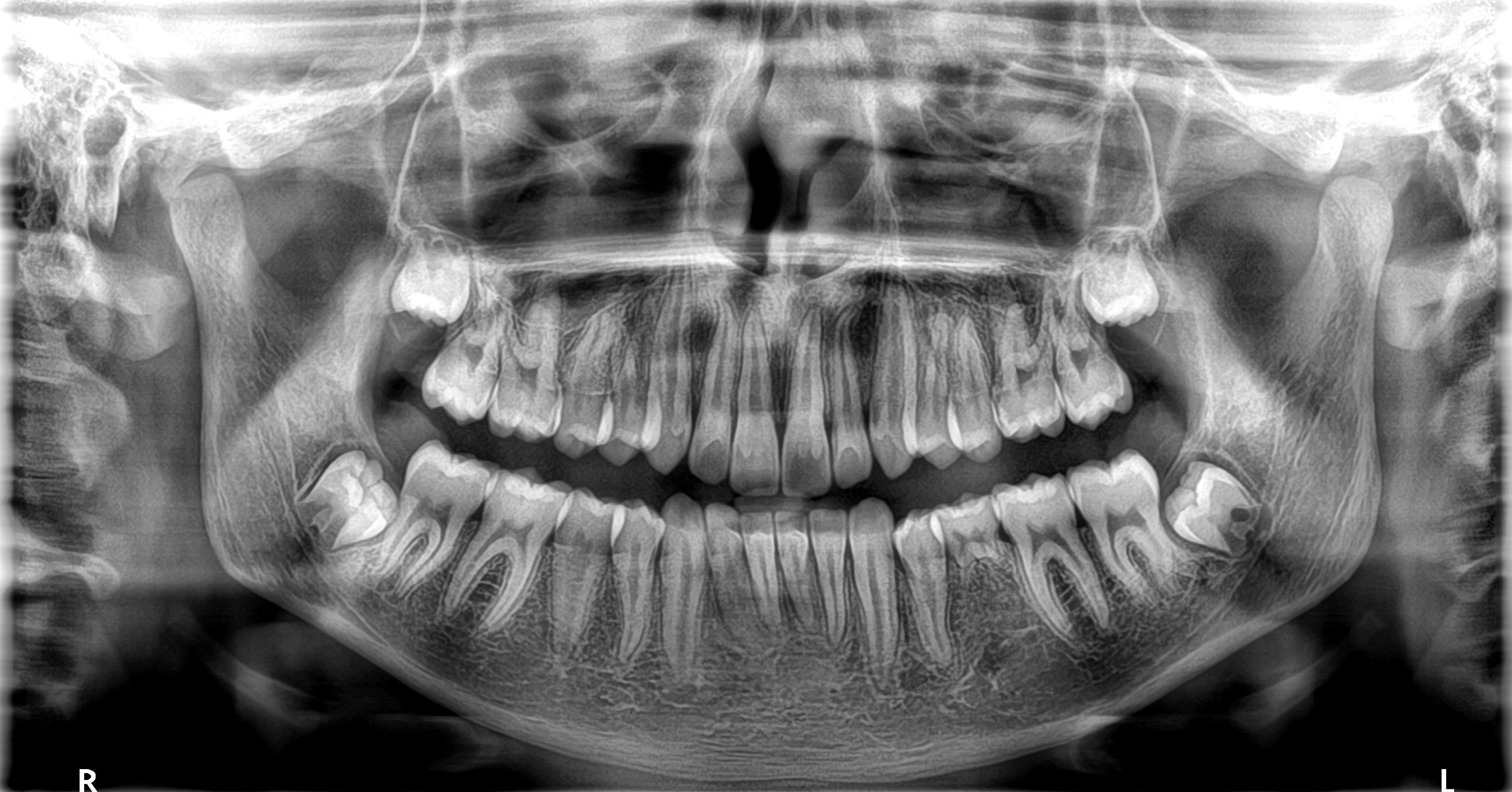 Digital x-ray technology: Bakersfield dentist