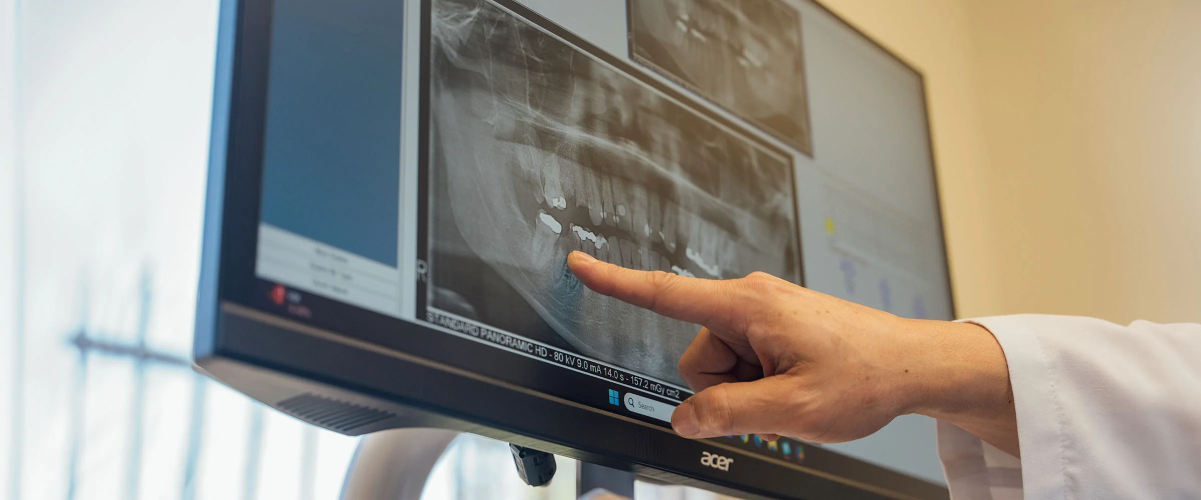 A person points at a computer screen displaying digital multimedia. The indoor setting features a flat panel monitor, with electronic devices in the background, creating a tech-focused atmosphere. - Composite Fillings in Bakersfield, CA