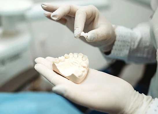 Close-up of a dental professional's hands holding a detailed model of teeth for educational or treatment purposes - Dental Crowns in Bakersfield, CA