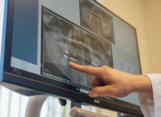 Dr.Huang pointing to a dental X-Ray - Dentist in Bakersfield, CA