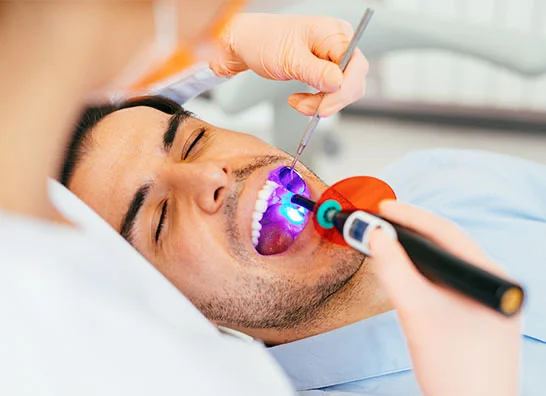 Close-up of a dentist performing a procedure using a curing light to harden dental material on a male patient's teeth, highlighting modern dental technology - Dental Sealants in Bakersfield, CA