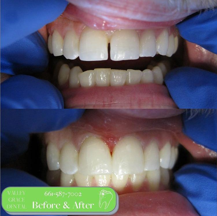 Real patient #5 before and after photo